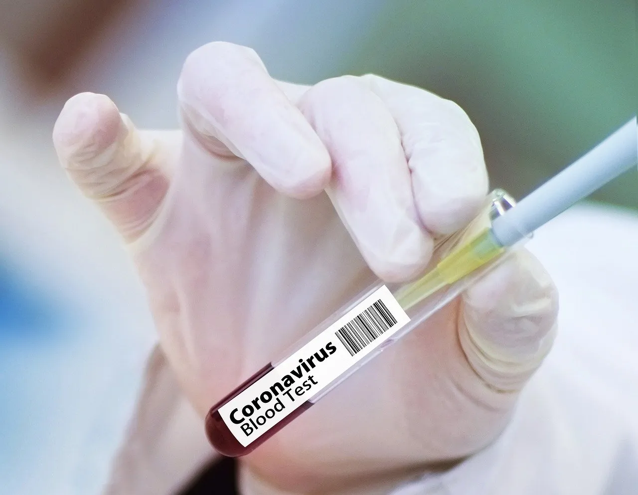 Nota sobre China avanza en desarrollo de vacuna contra el coronavirus 